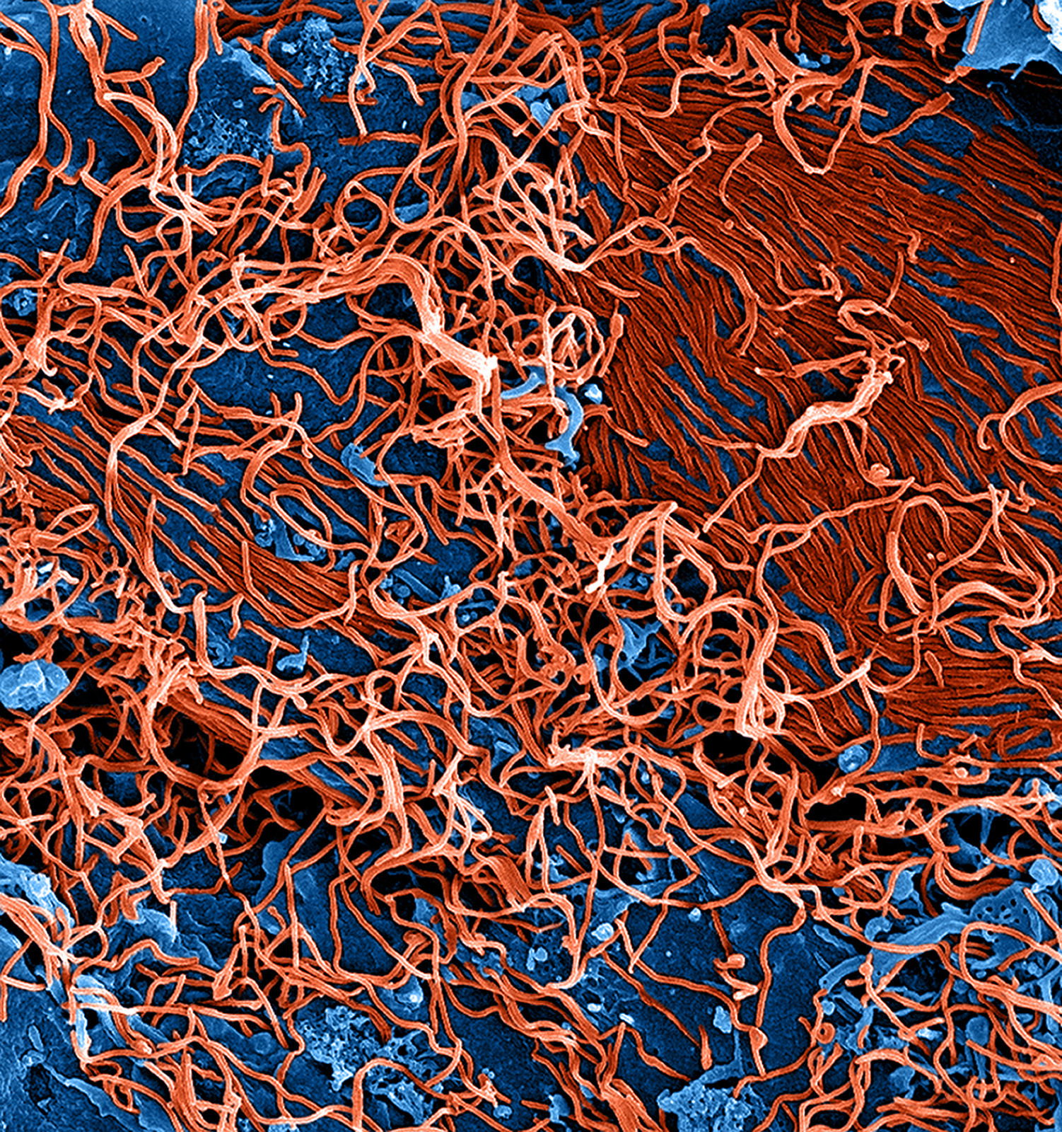 ebola virus