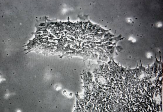 Il virus che rende stupidi preview