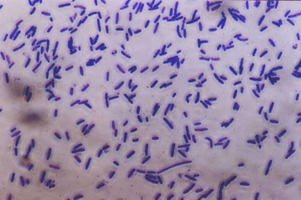 Cosa succede se usiamo male gli antibiotici article-post