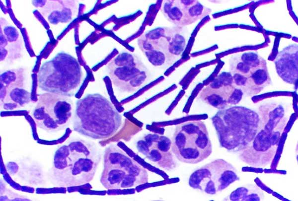 Come combattere i super batteri resistenti agli antibiotici article-post