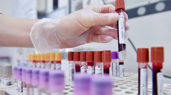 La sperimentazione del vaccino contro i tumori article-post