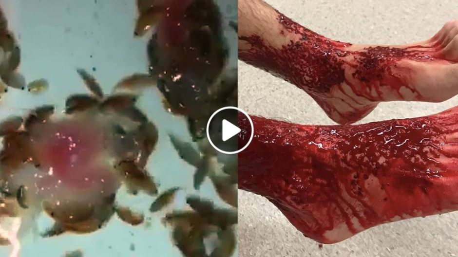 Le mini-creature marine che mangiano le gambe di un ragazzo in Australia article-post