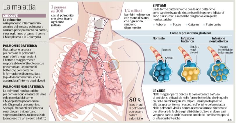 polmonite bresciano