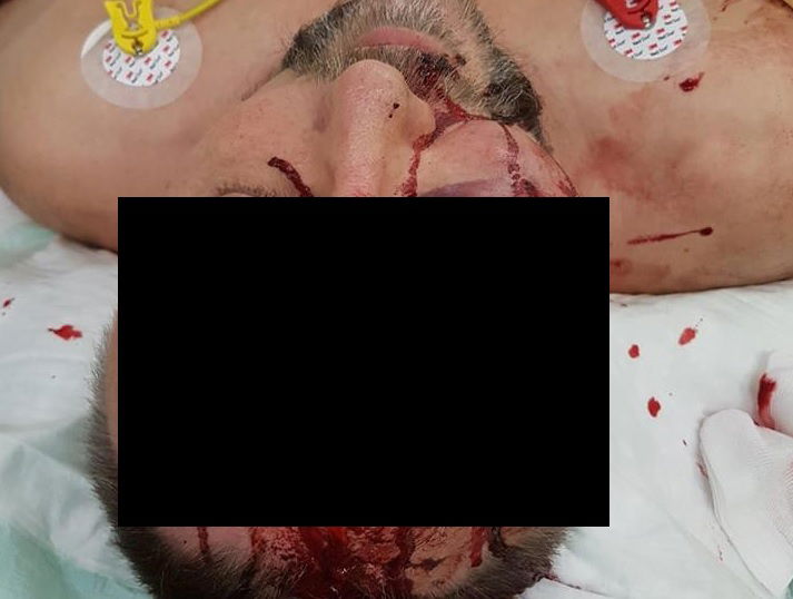 Il politico AFD a Brema non è stato aggredito e pestato article-post