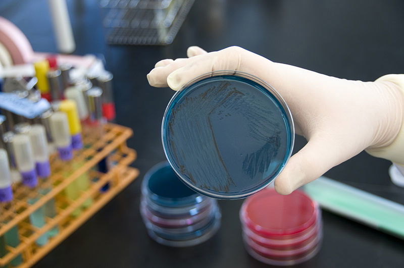 Salmonella nel latte per neonati: cosa dice il ministero della Salute article-post