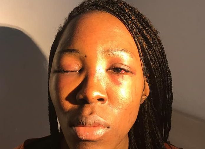 Megane Deutou: la ragazza che pubblica su Instagram le foto dopo le botte dell’ex article-post