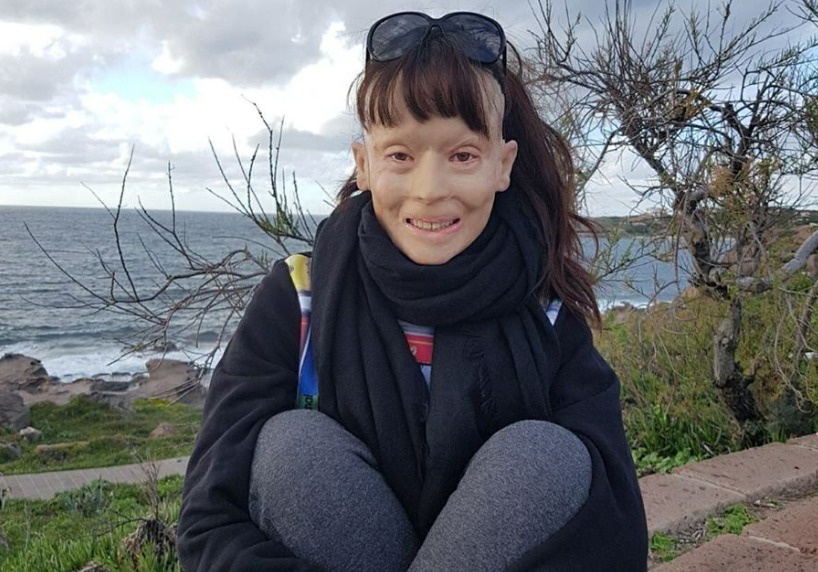 Valentina Pitzalis: archiviata l’indagine contro di lei article-post