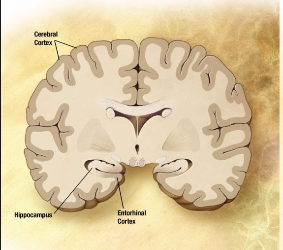 Il test del sangue che scopre l’Alzheimer vent’anni prima article-post