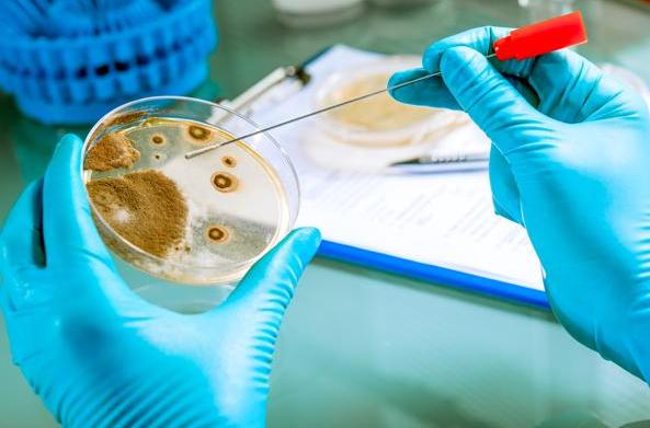 listeriosi come prevenire listeria 1