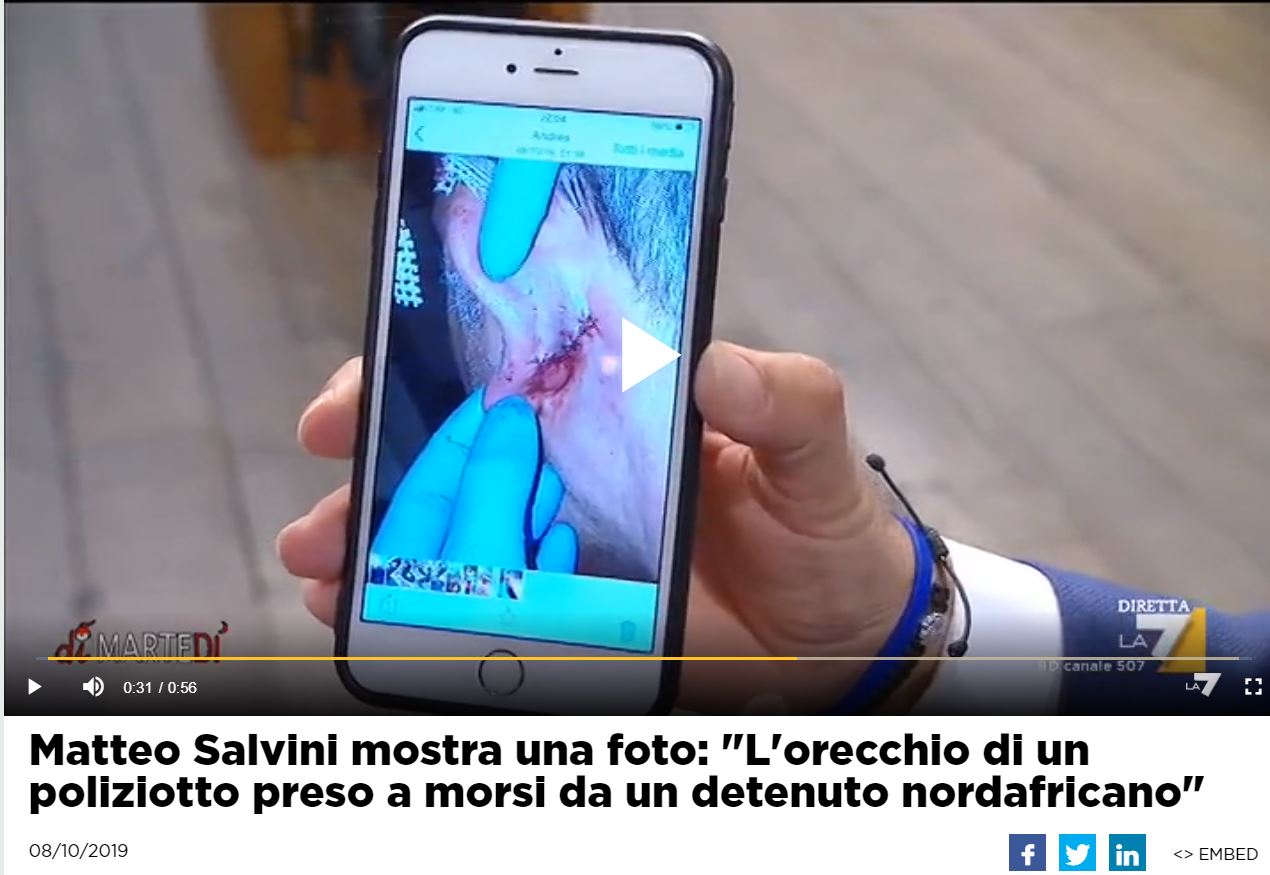 salvini morso orecchio detenuto 1