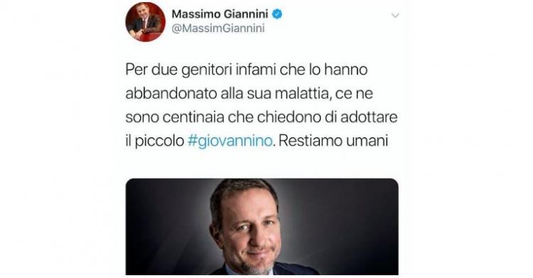 giovannino bambino ittiosi arlecchino abbandonato