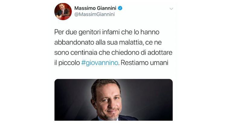 giovannino bambino ittiosi arlecchino abbandonato
