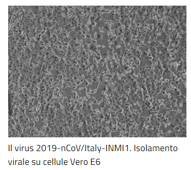 spallanzani coronavirus isolato fondi - 5