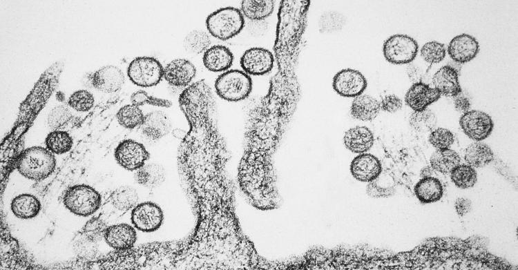 hantavirus hunan cina - 2