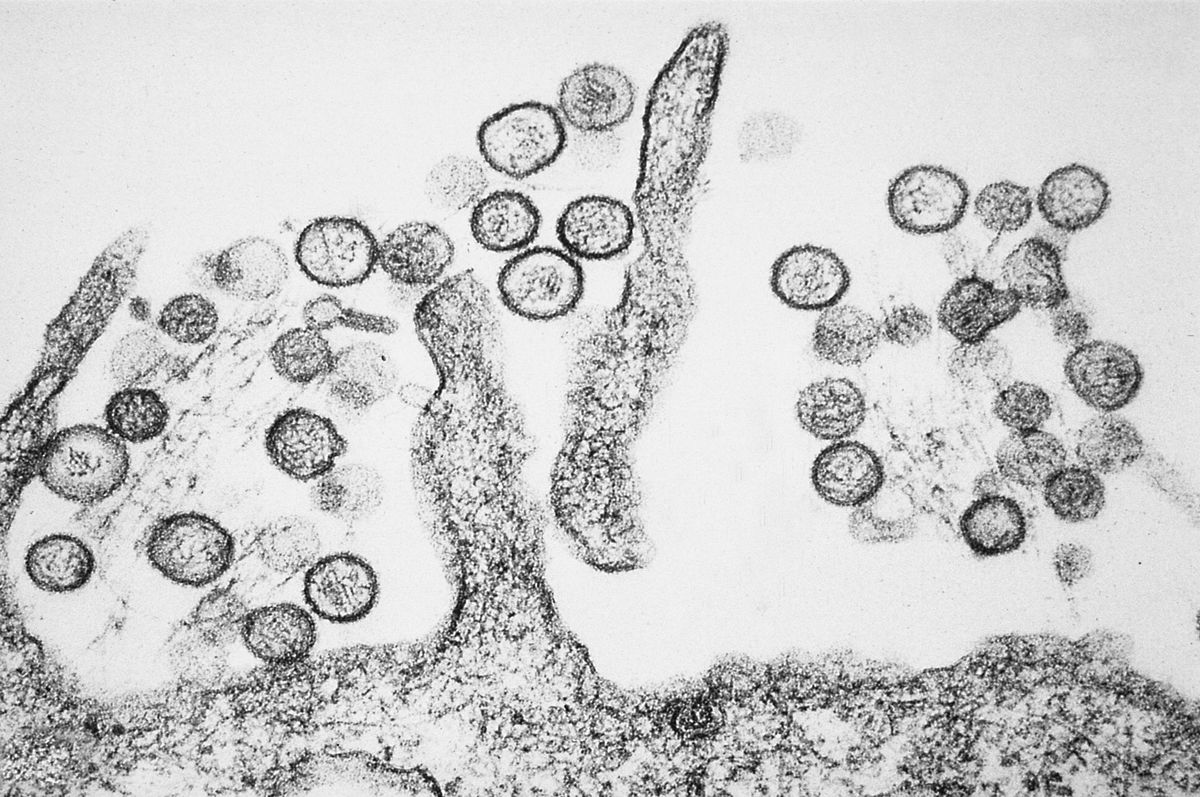 Hantavirus: perché la storia dell’operaio cinese morto per infezione non c’entra con una nuova pandemia article-post