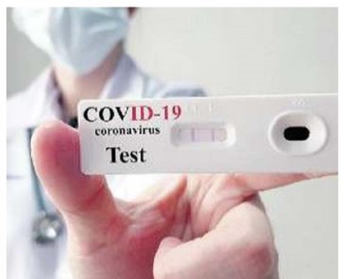 test salivare coronavirus