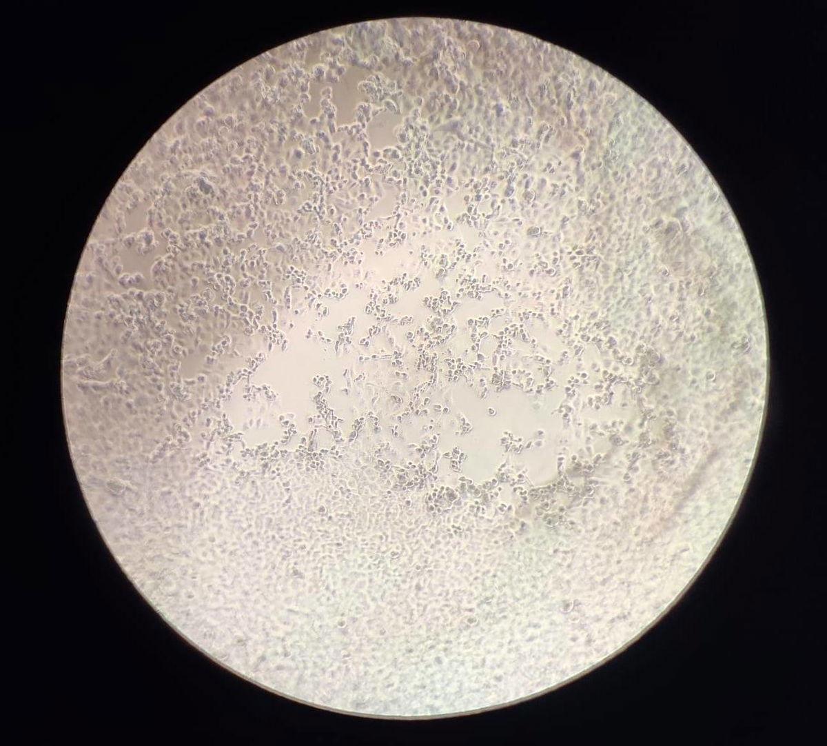 Che cosa significa essere debolmente positivi al Coronavirus article-post