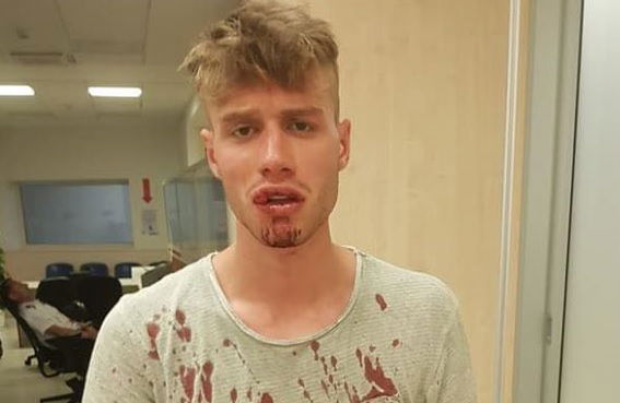 emanuele 23 anni picchiato polizia 1