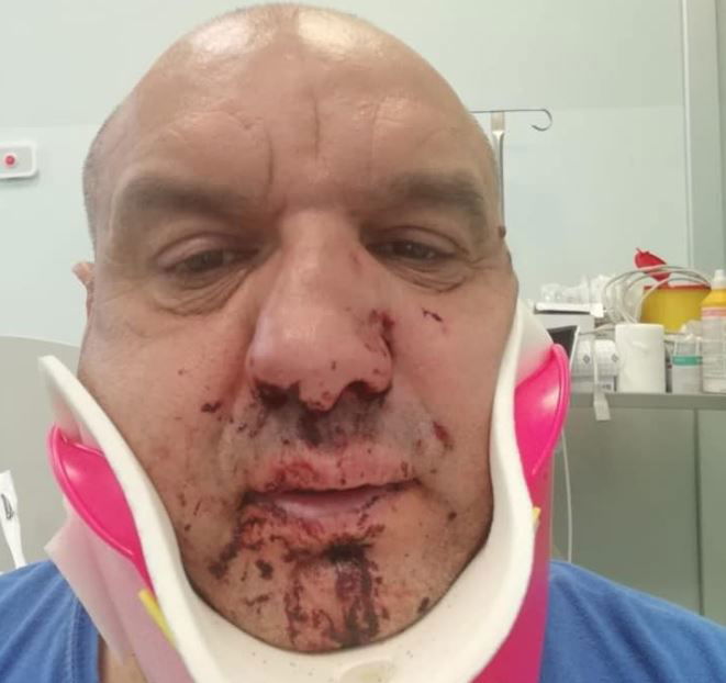 Il turista che prende a pugni il soccorritore del 118 article-post