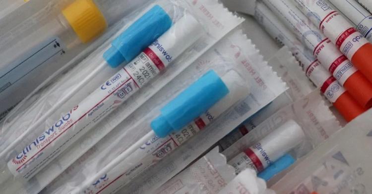 napoli truffa tamponi coronavirus civitavecchia roma