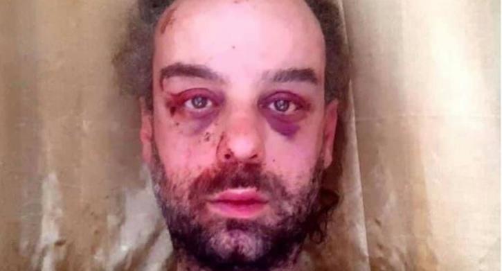 Fabio Tuiach omofobia attivista lgbt picchiato parisi 1