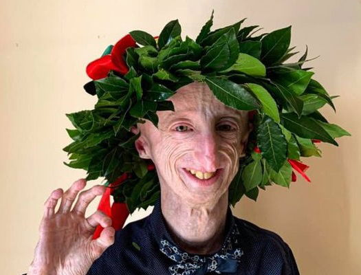 Sammy Basso, simbolo della lotta alle malattie rare, è dottore per la seconda volta article-post