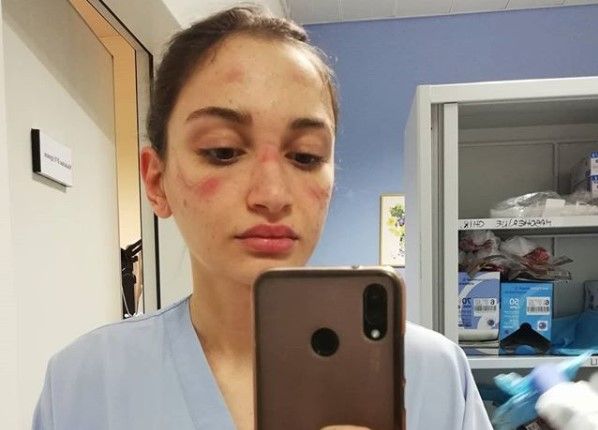 Alessia Bonari: chi è l’infermiera simbolo della lotta al COVID ospite a Sanremo article-post