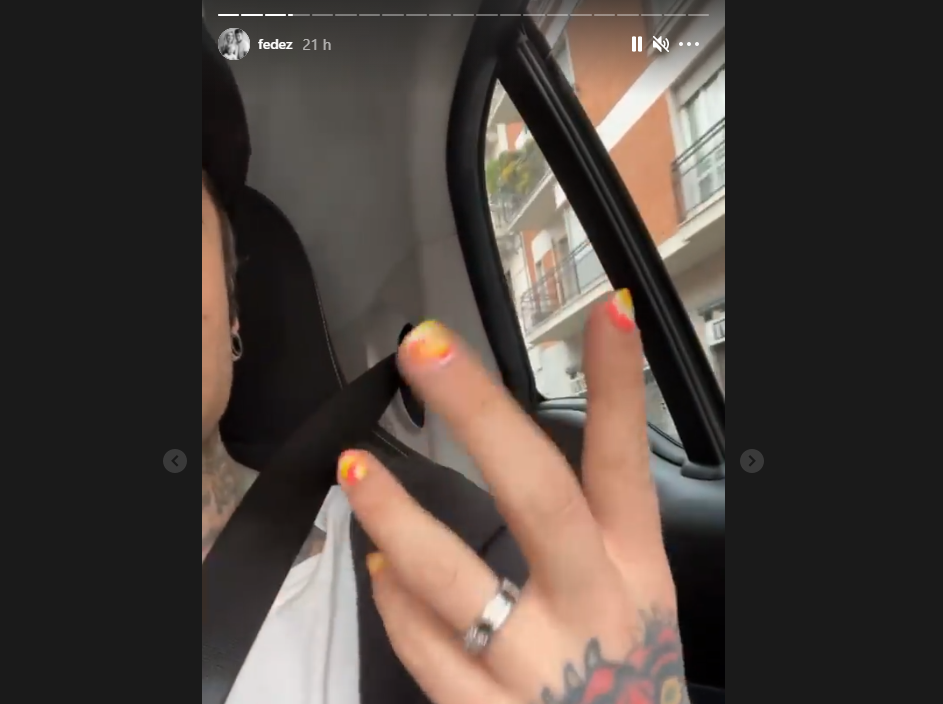 La risposta di Fedez all’assessora leghista che caccerebbe il figlio di casa se lo vedesse con lo smalto article-post