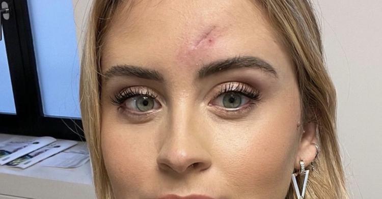 Carcinoma basocellulare Valentina Ferragni