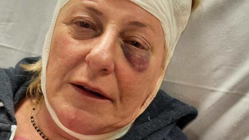 Claudia Cecconcello, la donna presa a calci e spinta per le scale dal vicino perché lesbica preview