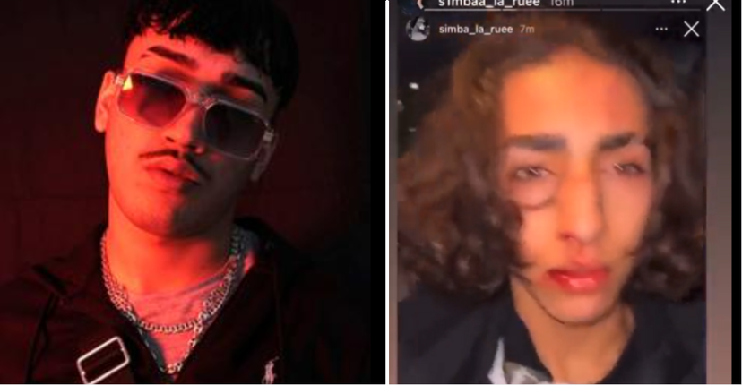 C’è una vendetta dietro Simba La Rue accoltellato? Il video di Baby Touche sanguinante article-post
