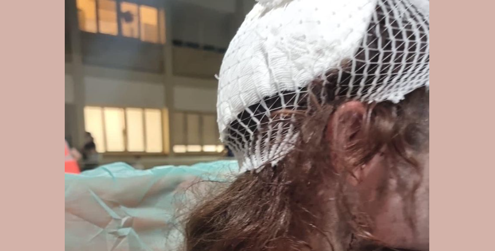 La violenta aggressione omofoba a una coppia di Bari il giorno dopo il Pride article-post