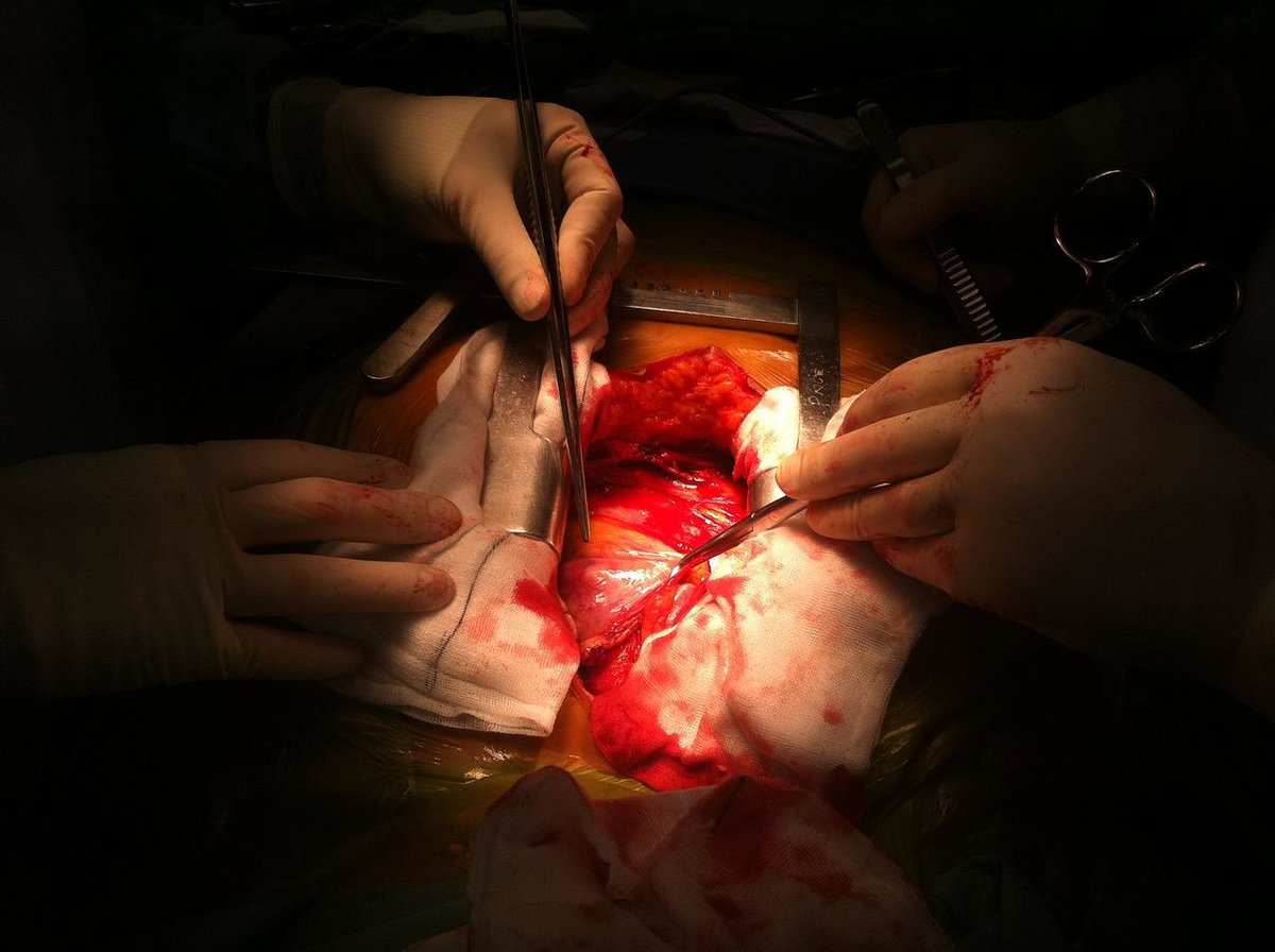 Il cuore cambia forma se corri o stai a riposo. Lo studio scientifico article-post