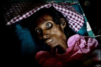 Francia, ragazza sieropositiva quasi guarita dall’AIDS article-post