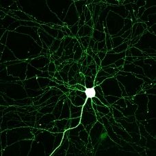 Il primo cervello in provetta è italiano. article-post