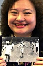 Ex bambina vietnamita del bombardamento al napalm si sottopone ad un intervento laser per ridurre le cicatrici article-post