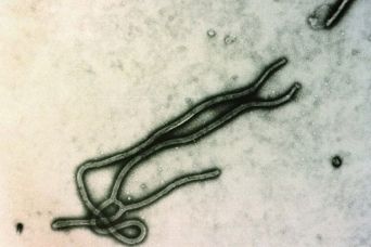 Ebola: sperimentazione nuovo farmaco AVI-7537. article-post