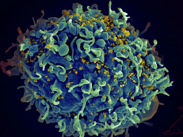 HIV: verso una cura? article-post