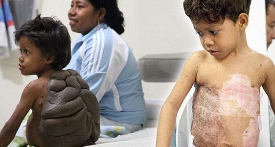 Il bambino tartaruga perde il suo guscio article-post