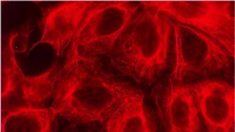 Un chip contro il cancro article-post