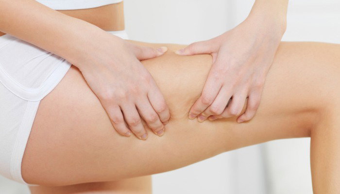 Le migliori creme anticellulite che funzionano article-post
