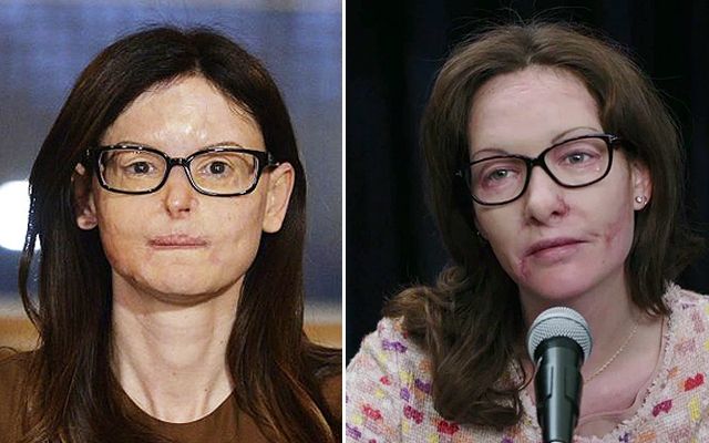 Lucia Annibali, una fiction con Cristiana Capotondi sulla giovane sfregiata con l’acido article-post