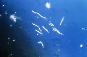 La malattia di Lyme nel cane article-post