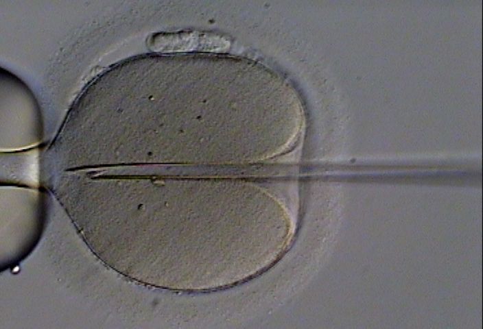 Fecondazione eterologa: ecco le linee guida article-post