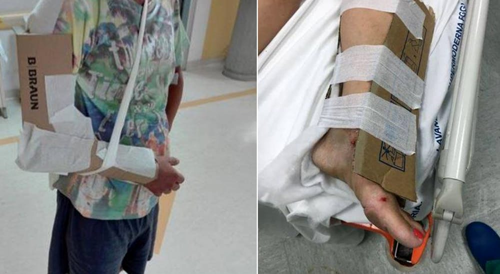 Reggio Calabria: in ospedale manca il gesso article-post