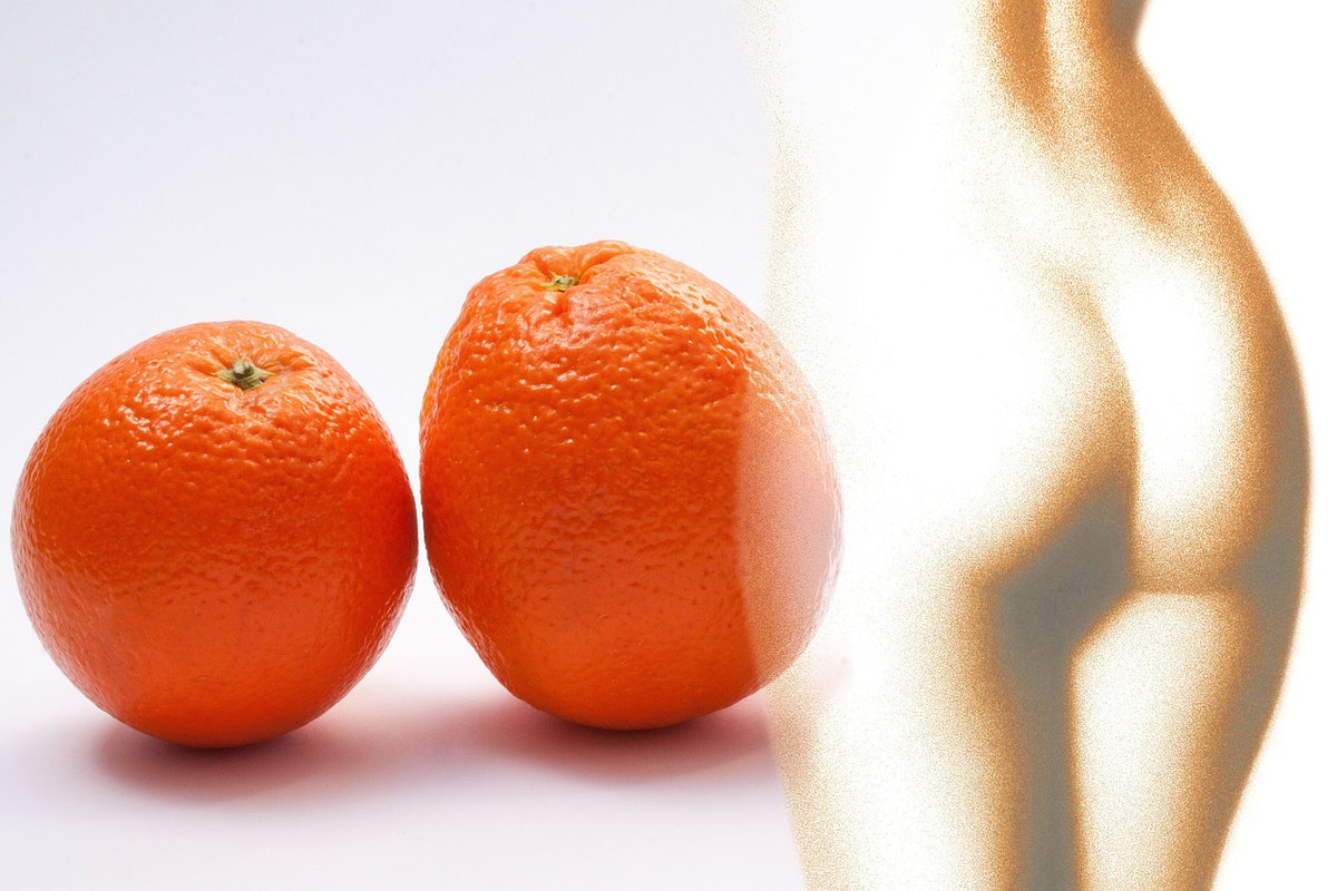 Falsa cellulite e rilassamento cutaneo, cause e cura article-post