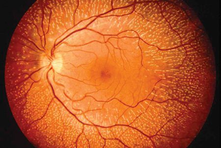 La prima retina umana in provetta article-post