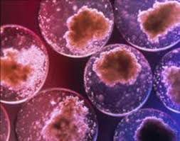 Clonazione del diabete giovanile: cure senza effetti collaterali article-post