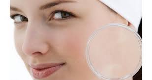 Viso più bello? Abbiamo la soluzione article-post