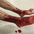 Video, Parassiti in mare divorano caviglie di un 16enne article-post